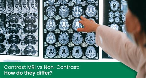 the villages brain mri with contrast|MRI Scans with Contrast and How They Differ From .